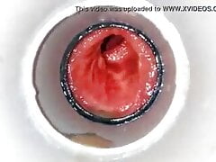Anal hole