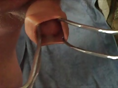 Foreskin videos