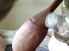 Spoon in foreskin #1