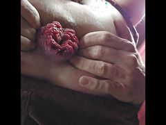 Small Prolapse gaping rosebud at work