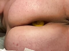 Limon insertion