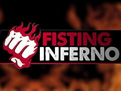 FistingInferno - Doctor Rams Massive Dildo In Patients Ass