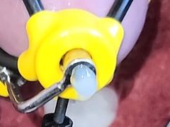 New estim accessory HFO