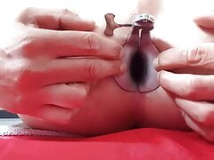 Speculum