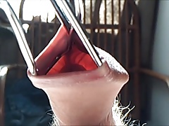 Foreskin sunlight cumshot !