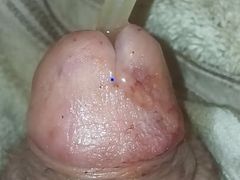 Inflated Bladder