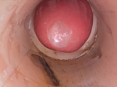 The Camera in the Deep Beaver Records a XXL Orgasm of Pearl juice Into the Protection