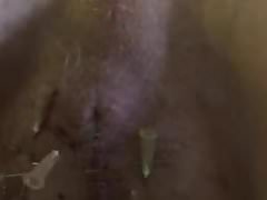 Needles and fist