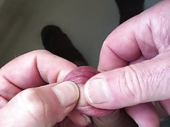 Standing foreskin - 2 of 4 - plastic tube