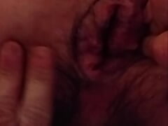Fingering prolapse