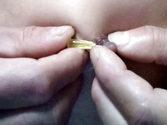 Niple needle