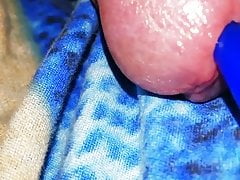 inserting silicone into the urethra