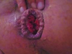 Anal fingering