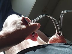 Ice in foreskin
