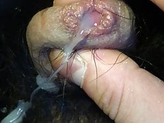 ejaculation