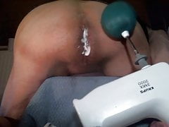 FFickBBare - electric whisk - anal - 01