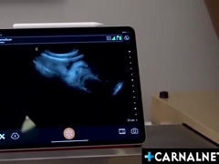 Doctor And Nurse Checking Twinks Vomb With Ultra Sound