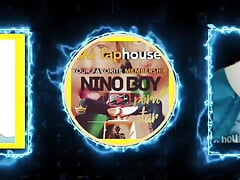 Young Boy Opens His Ass Until He Bursts It