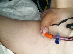 xH_Handy_Meine Fill bladder with groats with intestinal tube 10 mm from 18.08.22