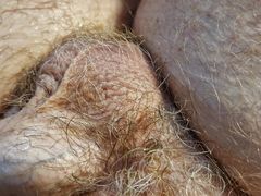 The final episode of hairy balls