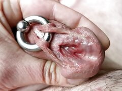Subincision & Piercing