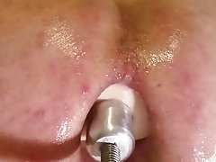 Over penetrated pt 2