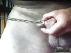 penectomy