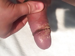 Smegma and grime after two weeks without cleaning
