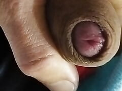 The appearance of the head of the penis in different situations